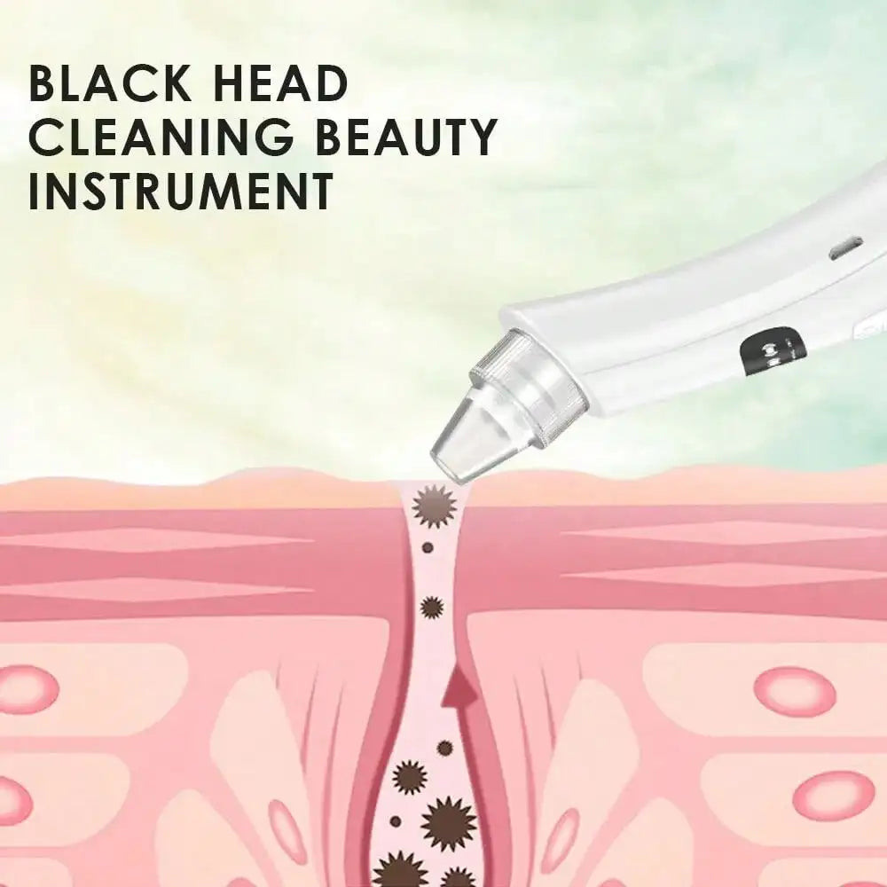 Aparelho de Limpeza Facial por Sucção com 3 Modos – Removedor de Cravos e Pele Morta Recarregável